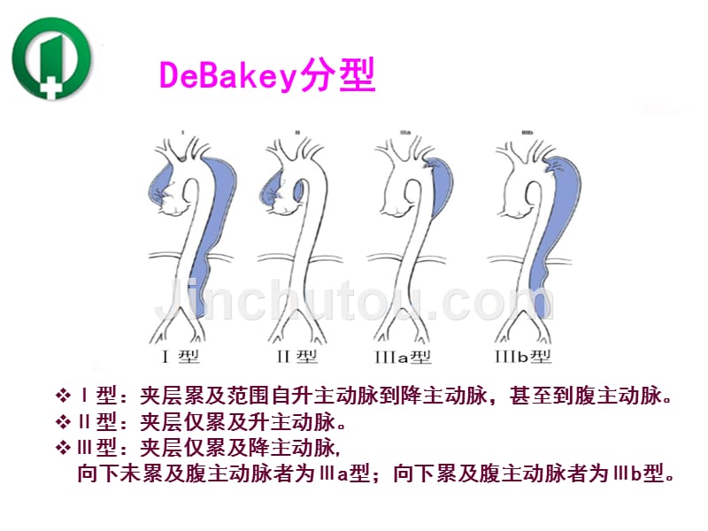 个案查房D组例主动脉夹层术后患者并发肺不张的护理_第4页