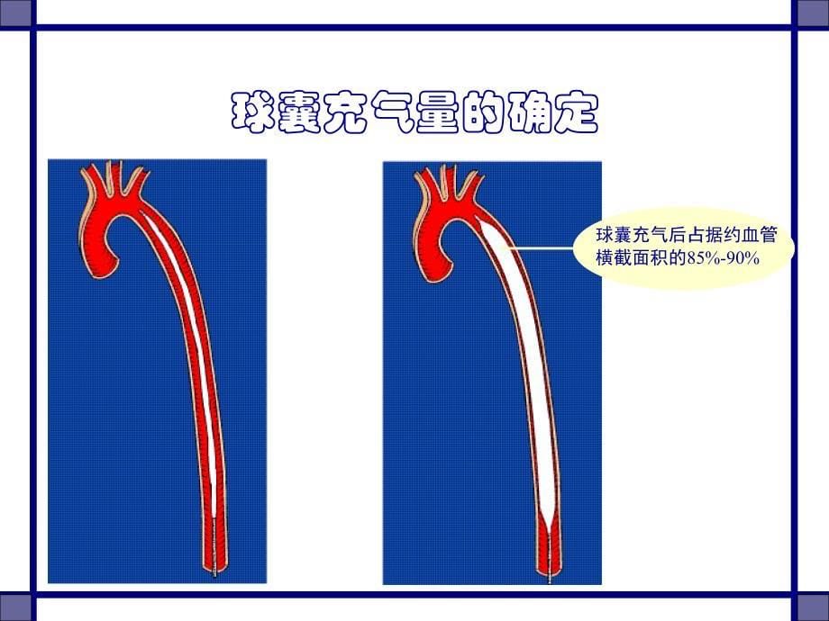 arrow autocat2 入门教程_第5页