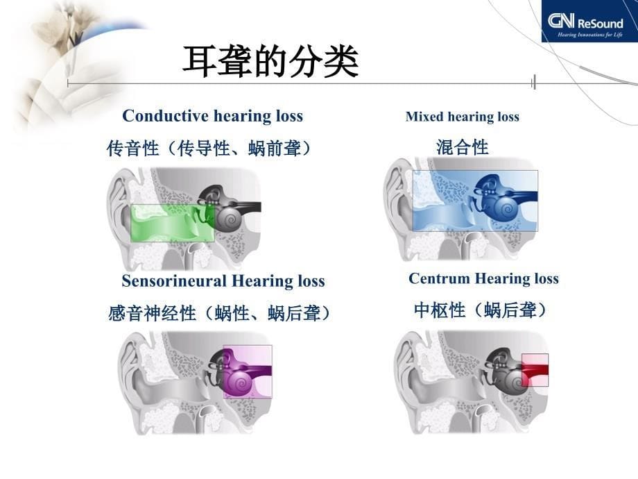 耳聋的病因与分类_第5页