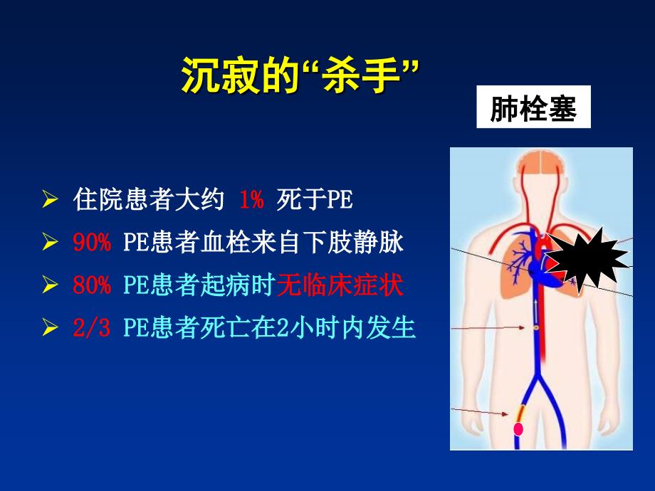 深静脉血栓防治策略_第4页