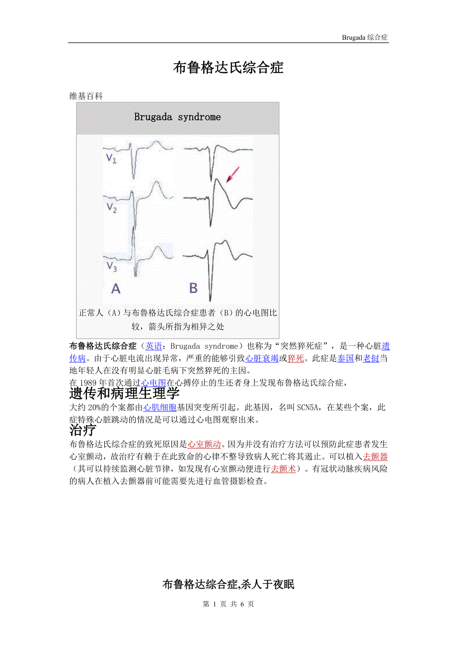 布鲁格达氏综合症_第1页