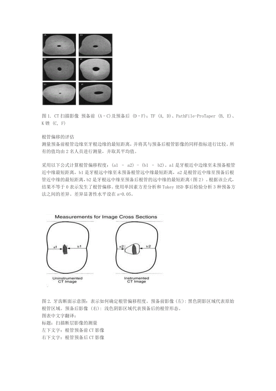 主流镍钛器械的弹性性能比较_第3页