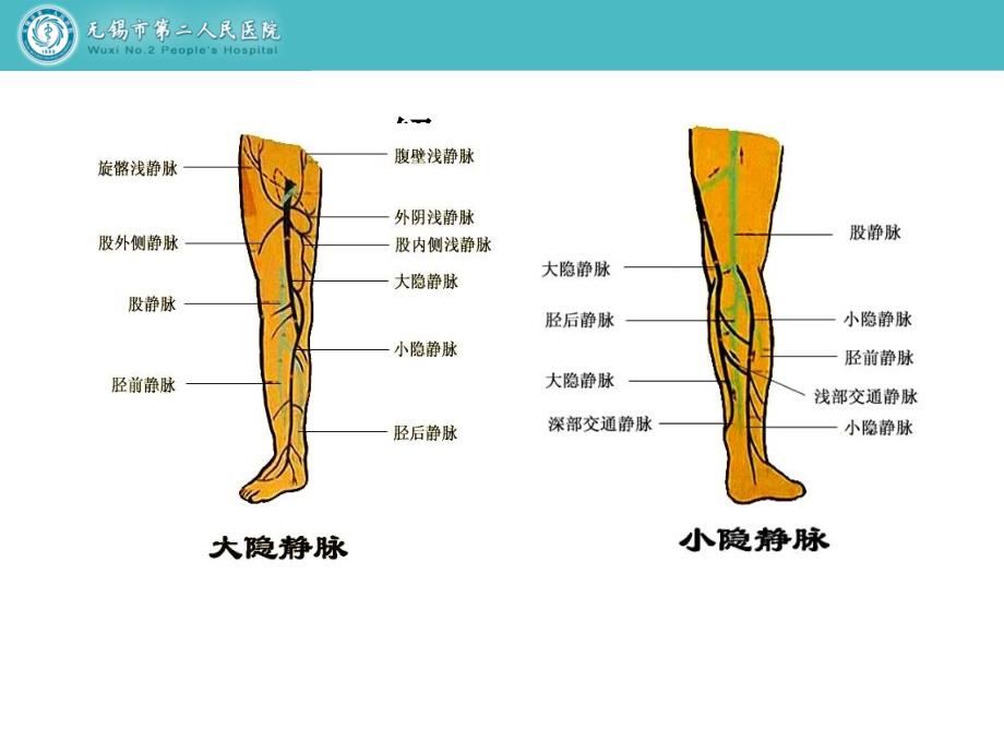 下肢静脉常见疾病的诊治冯军_第3页