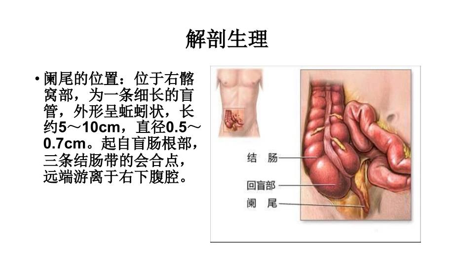 急性阑尾炎病人的护理_第4页