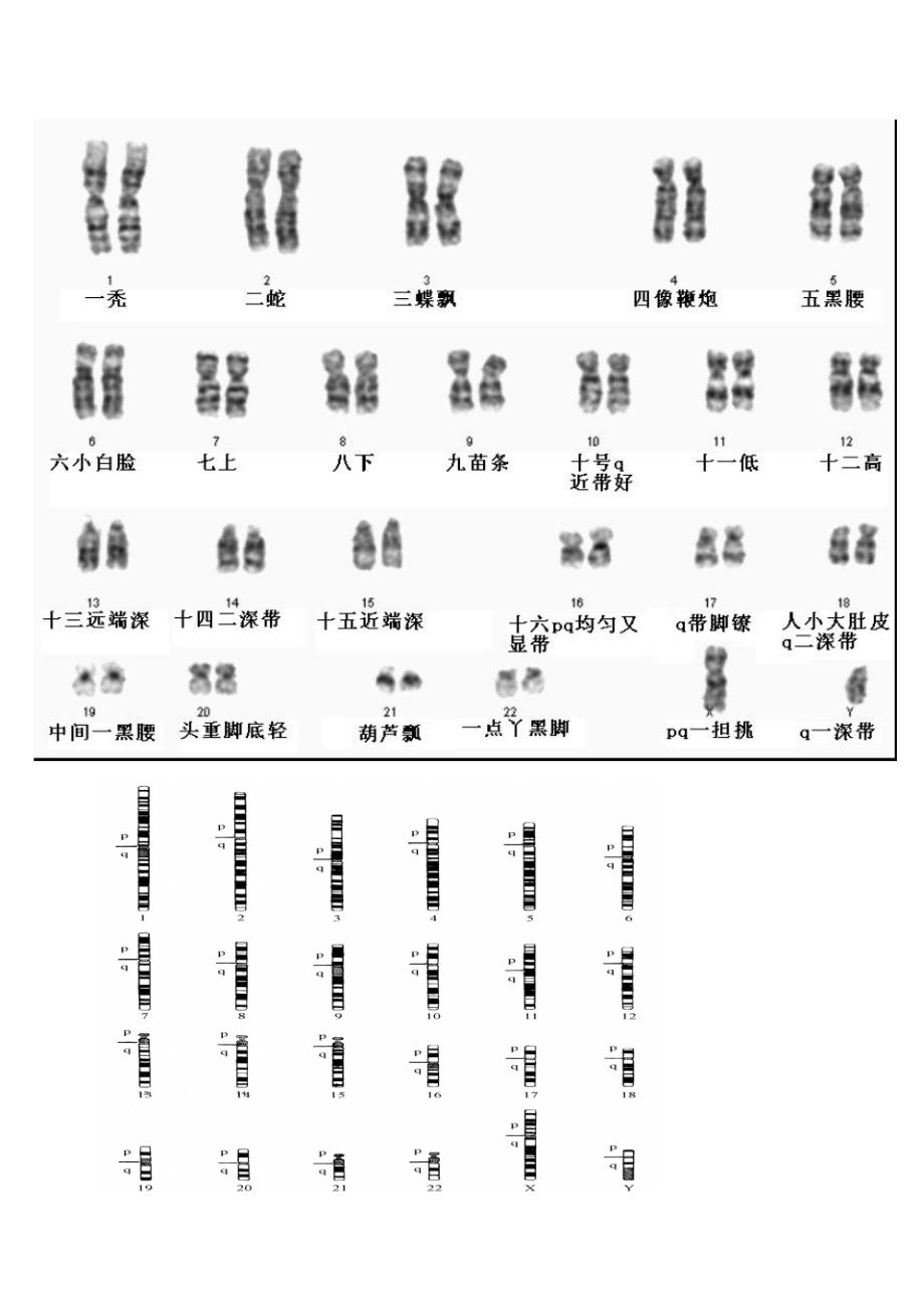 人类染色体图谱+口诀(全套46条)_第1页