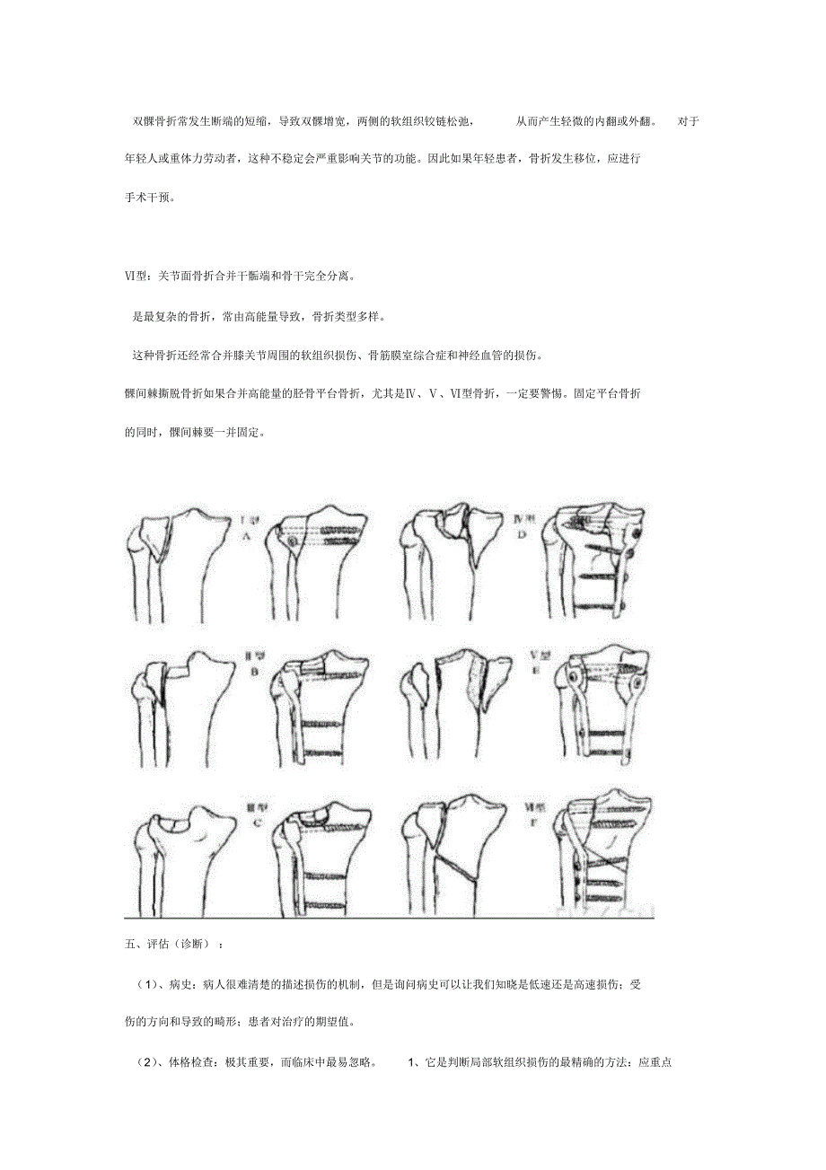 胫骨平台骨折分型及治疗_第4页