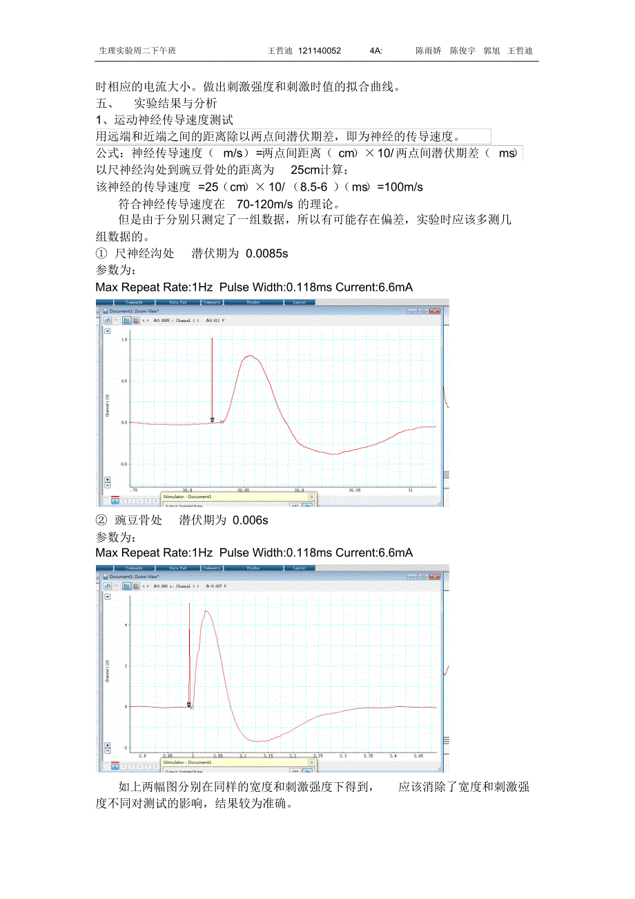 人体运动神经传导速度测试大鱼际肌电图描记_第3页