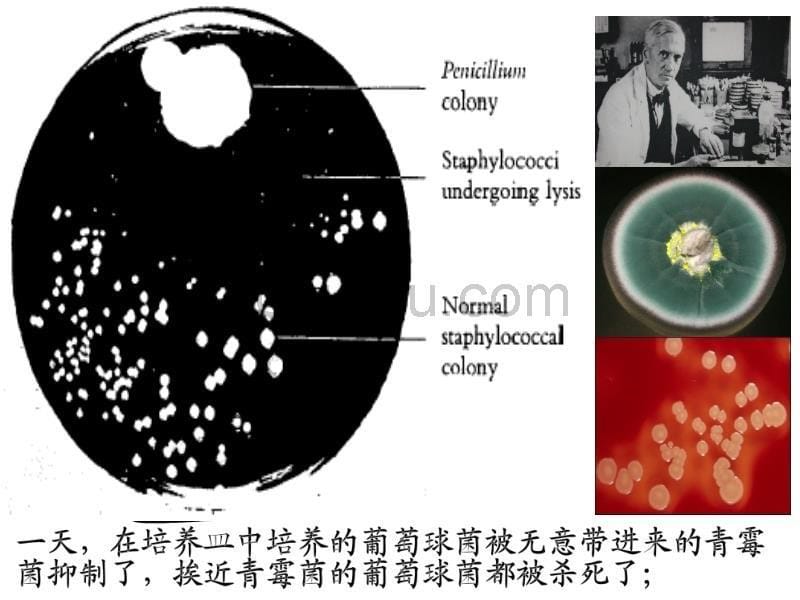 微生物耐药机制_第5页