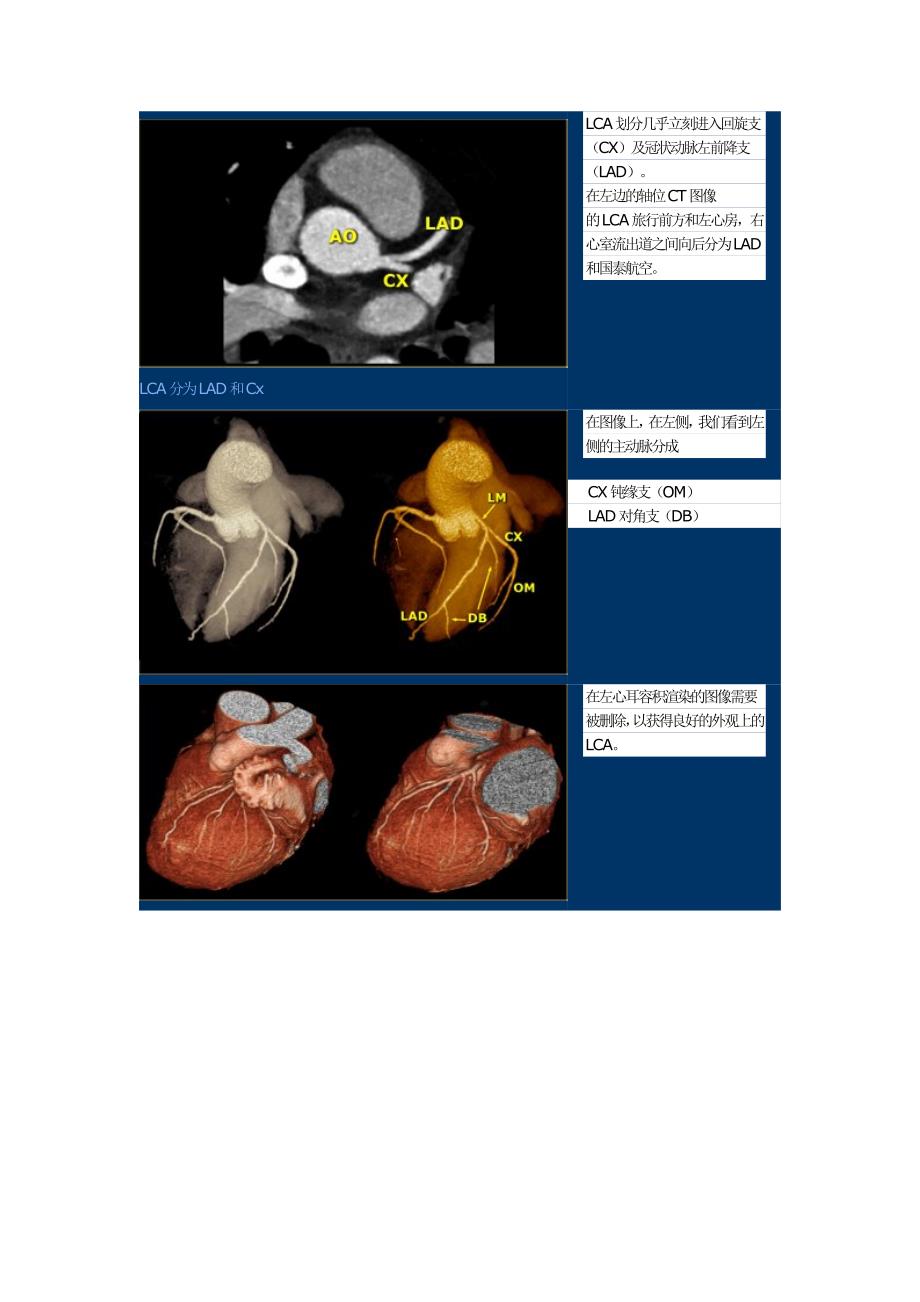 冠状动脉解剖和异常_第3页