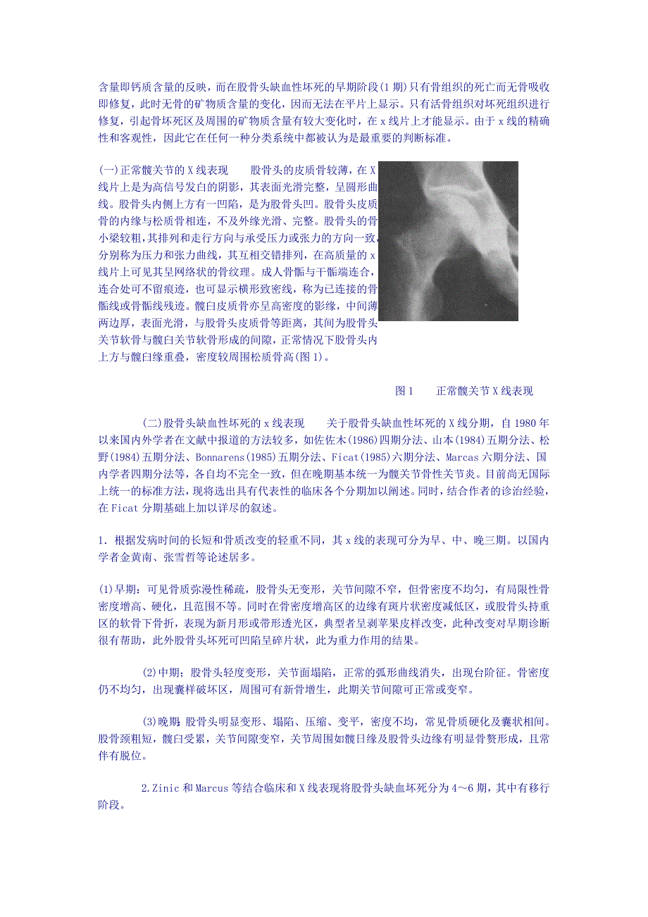 股骨头坏死的诊断要点及临床表现_第2页