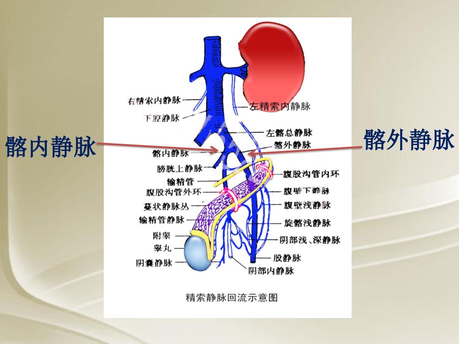 睾丸精索静脉曲张病因,症状及治疗_第4页