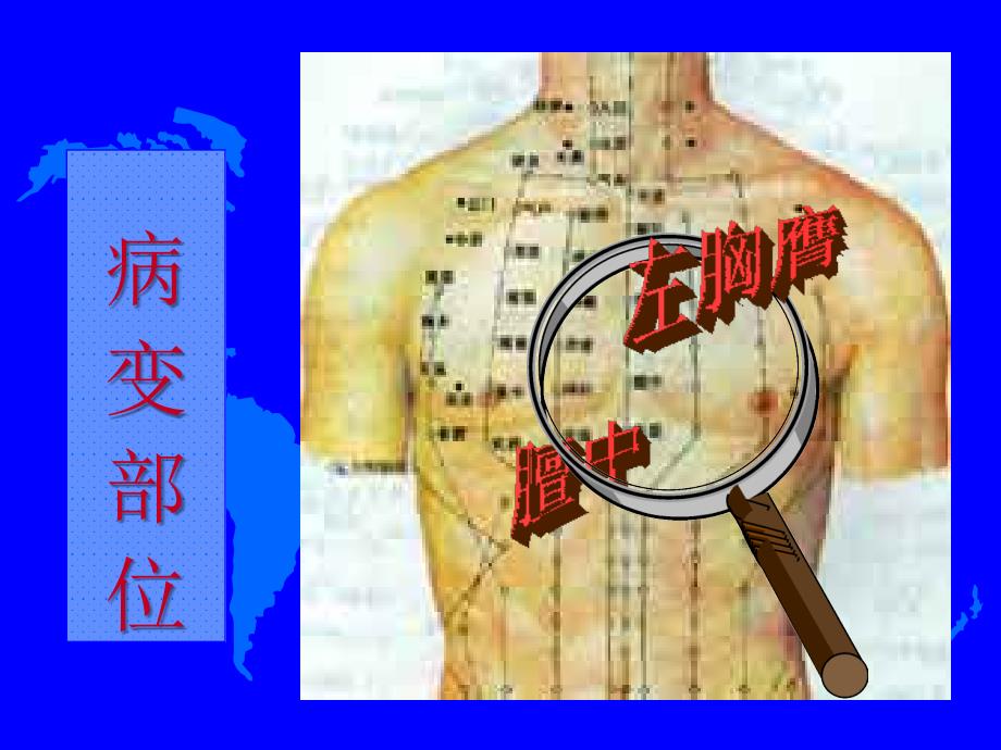 中内胸痛心痹_第4页