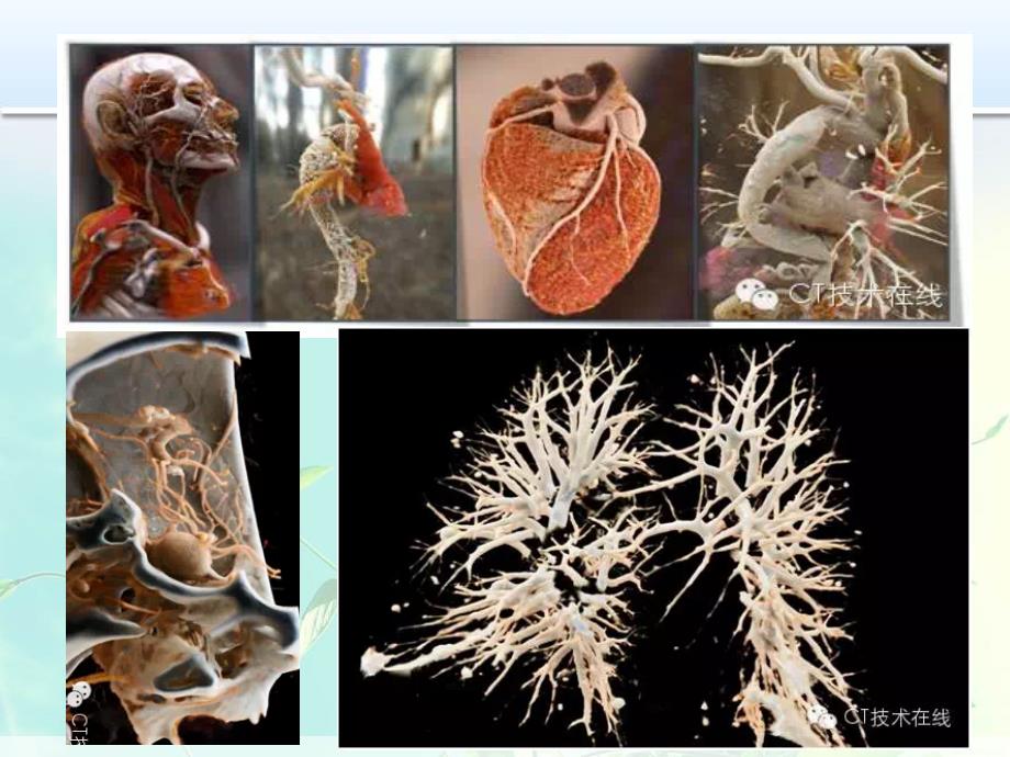 CT三维的临床应用_第3页