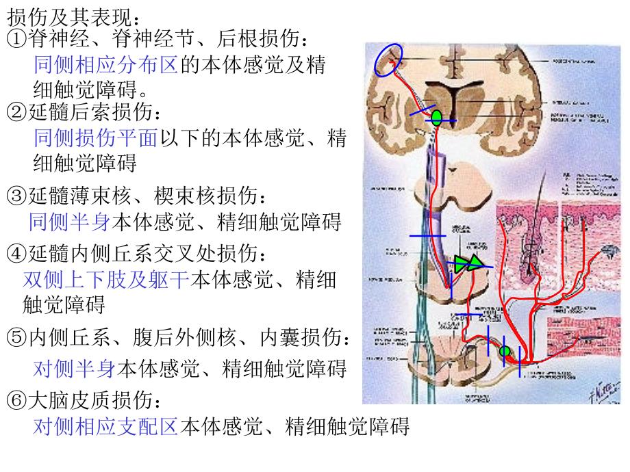 人体解剖之脑和脊髓的传导通路_第3页