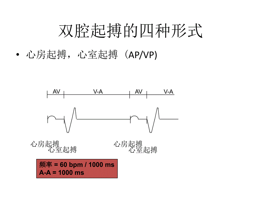 双腔起搏器技术及临床心电图表现要_第3页