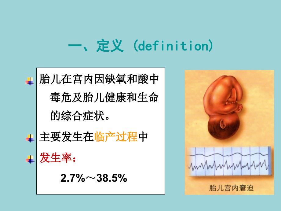 妇产科学胎儿窘迫胎膜早破_第4页