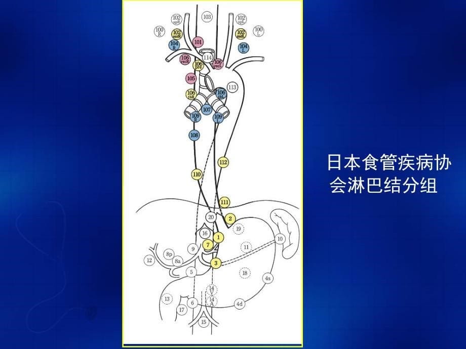 食管癌淋巴结的CT分区_第5页