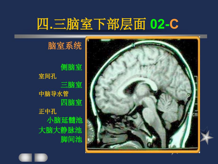 四.三脑室下部层面解剖要点_第4页