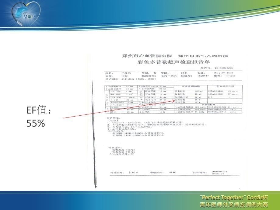 分叉病变病例_第5页