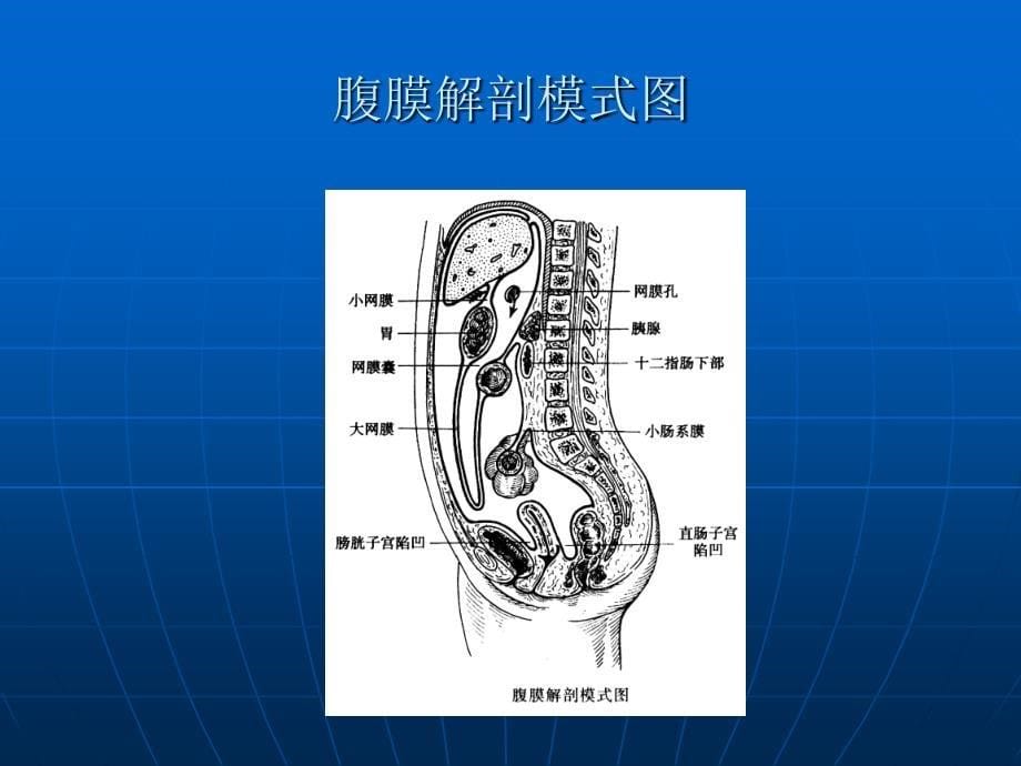 30-急性腹膜，李威_第5页
