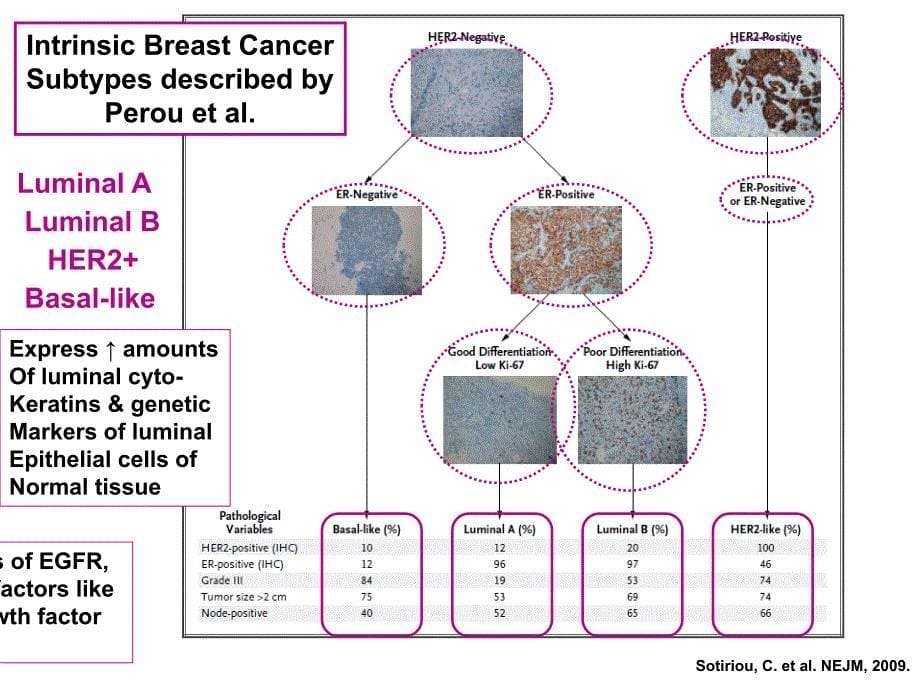 乳腺癌个体化治疗-多种分子诊断方案比较_第5页