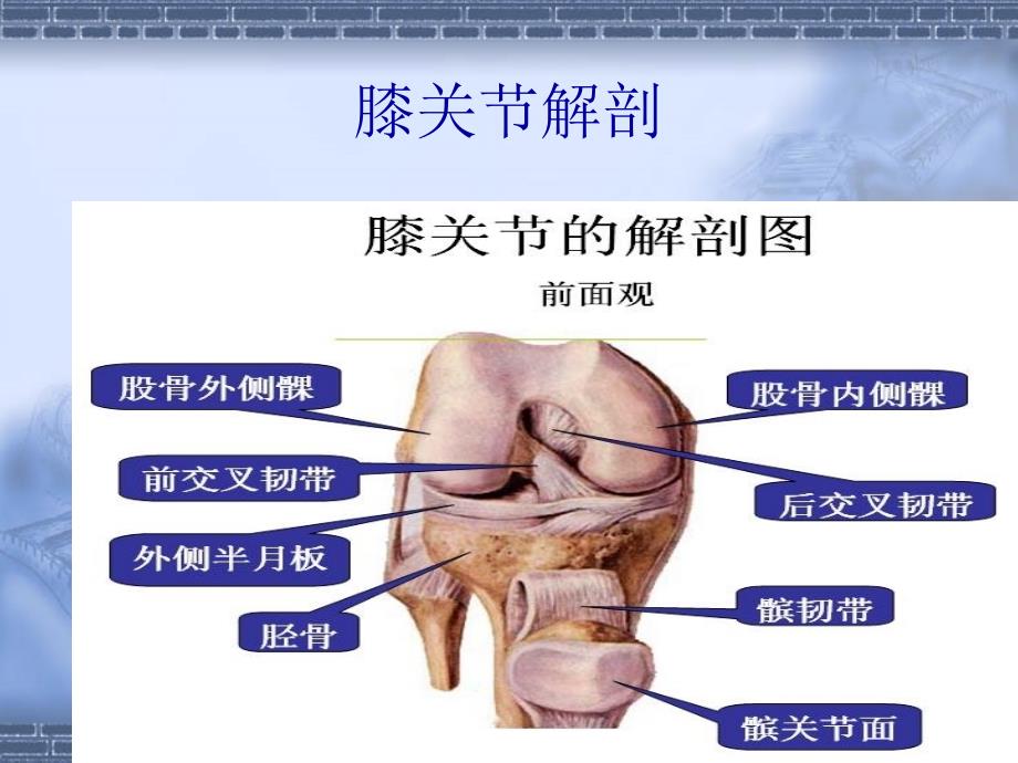 科普膝关节骨性关节炎的_第4页