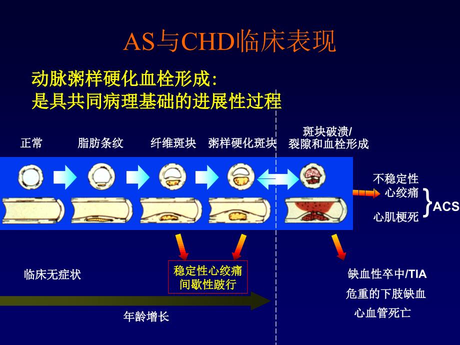 稳定型心绞痛诊断治疗_第2页