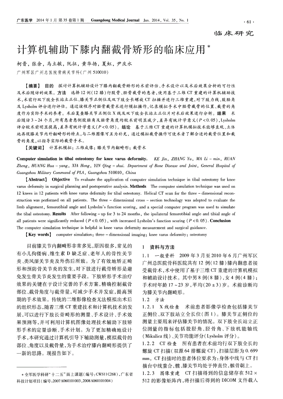 计算机辅助下膝内翻截骨矫形的临床应用_第1页