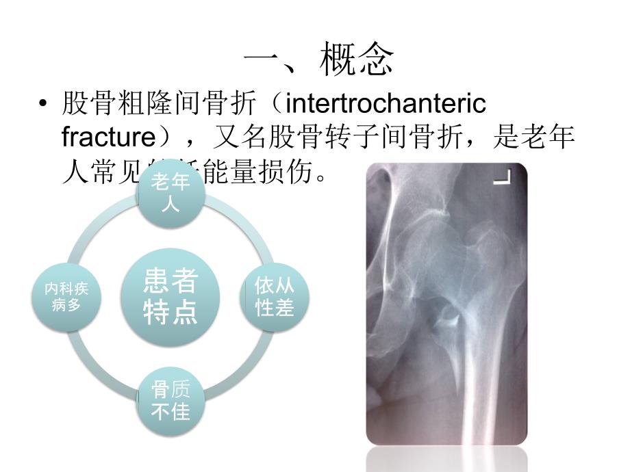 PFNA在股骨粗隆间骨折的应用摘要_第3页