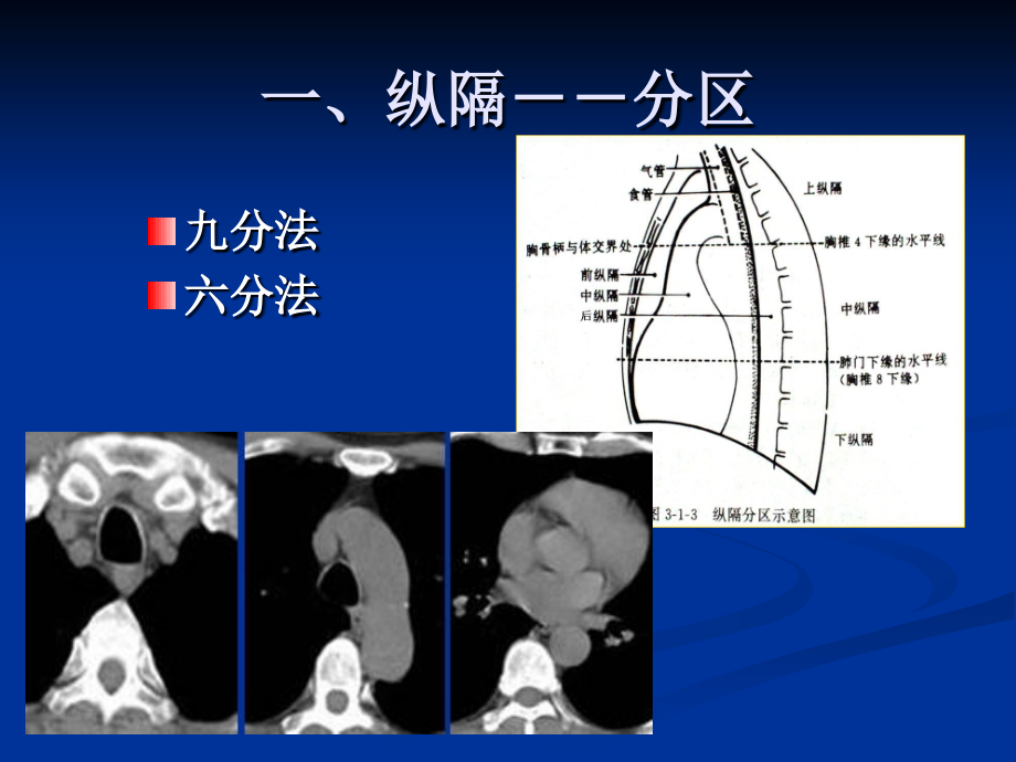 胸部常见疾病CT诊断与鉴别诊断_第4页