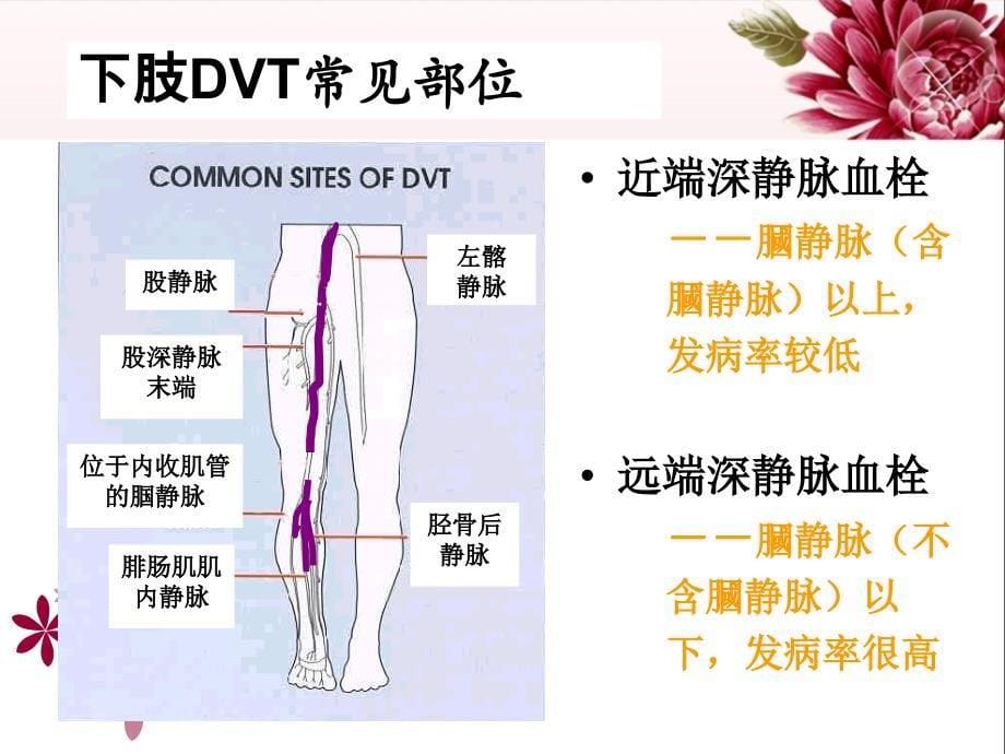 DVT下肢静脉血栓的预防及护理[1]_第5页