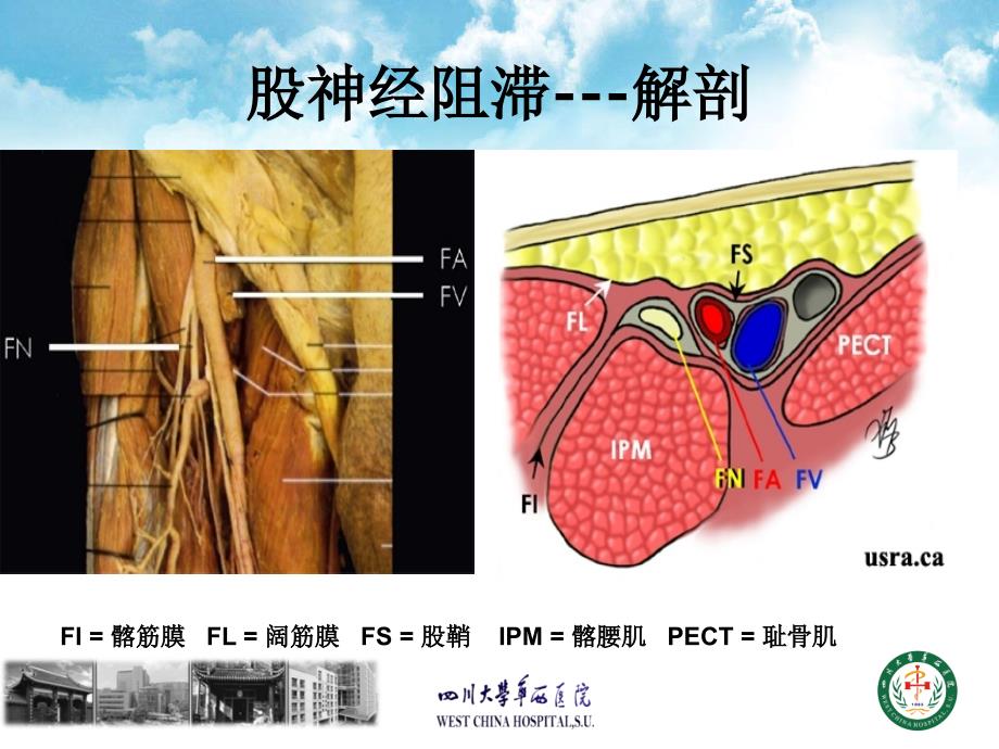 20140402pm 超声引导下肢神经阻滞--梁鹏_第3页