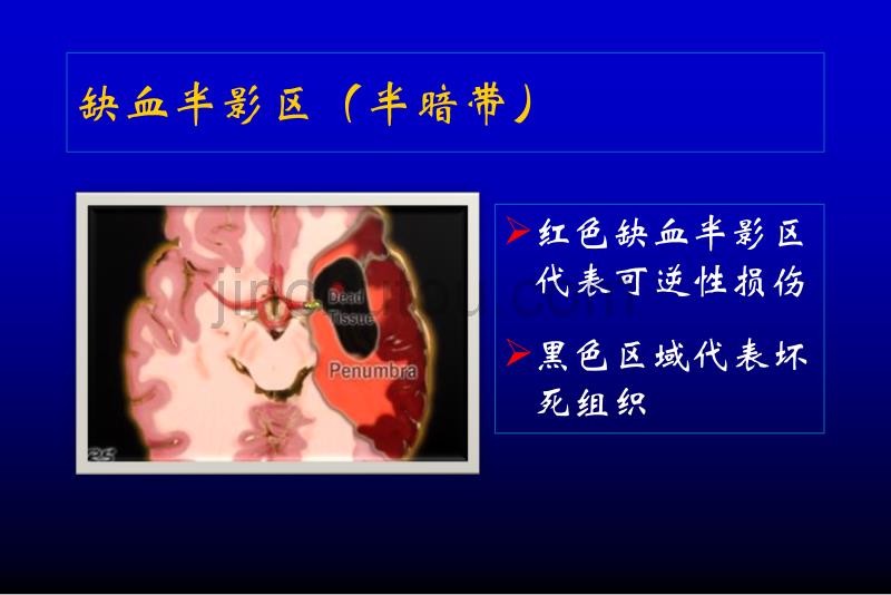 脑缺血—急性脑梗死的影像学表现_第4页