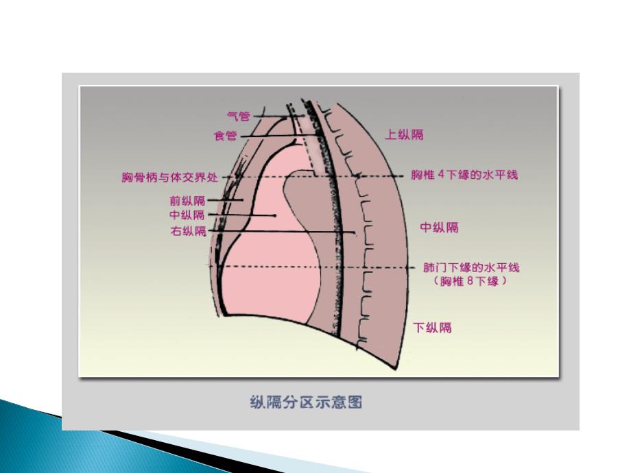 纵膈肿瘤影像诊断_第3页