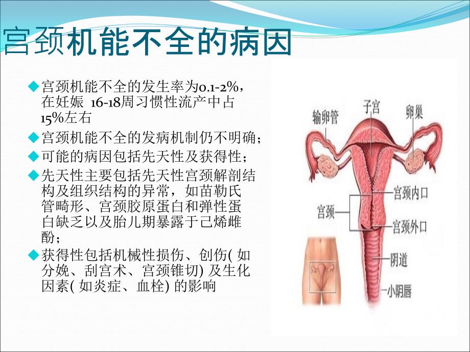 宫颈机能不全和宫颈缝扎术_第2页