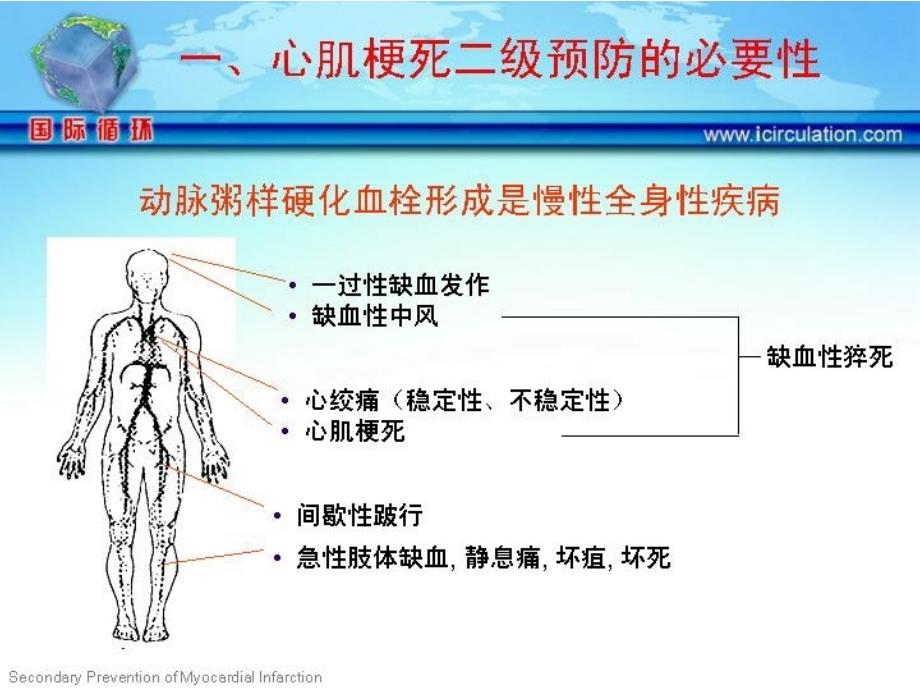 冠心病心肌梗死的二级预防_第2页