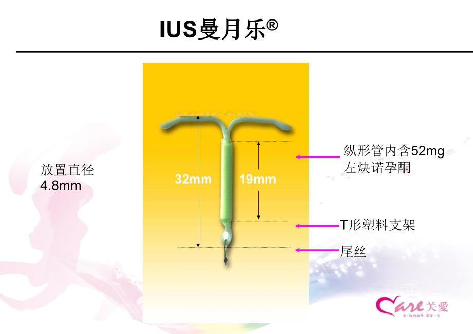 曼月乐在治疗领域的应用2012-04-21修改_第4页