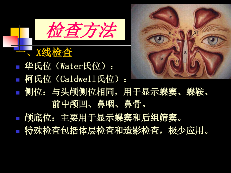 鼻及鼻窦影像诊断111_第2页