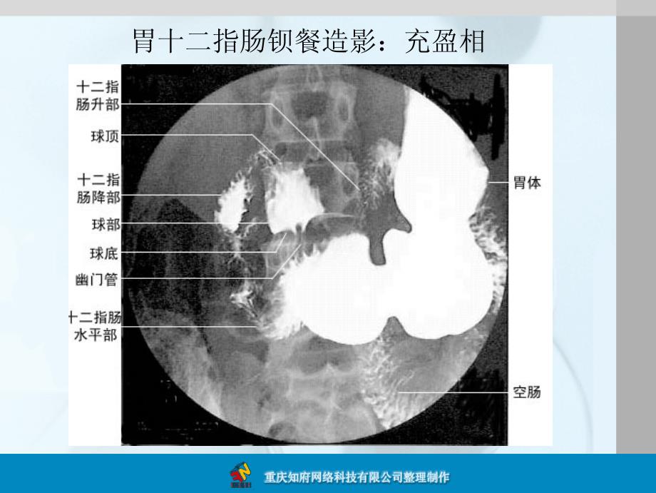 正常消化道造影X线解剖图谱_第4页