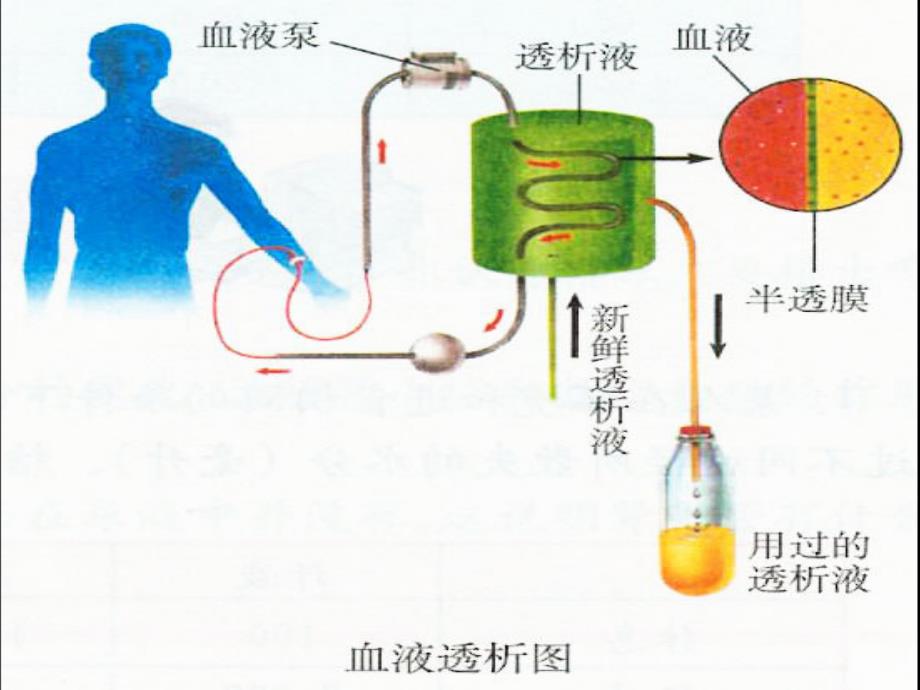 血液透析适应症及相应禁忌症_第3页