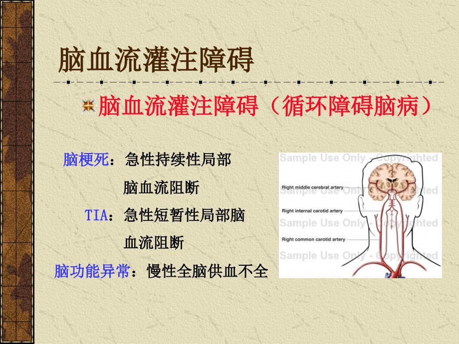 慢性脑血管供血不足_第4页