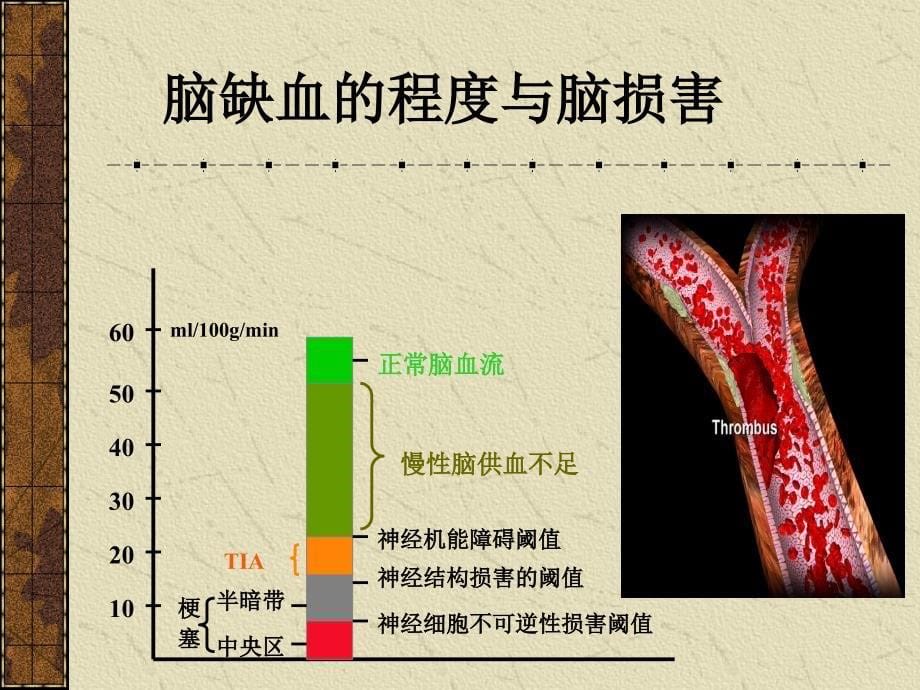 慢性脑血管供血不足_第5页