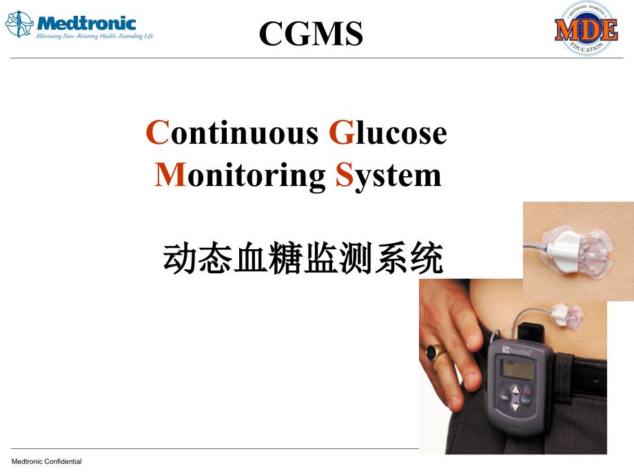 动态血糖监测（CGMS）基本原理和临床应用_第2页