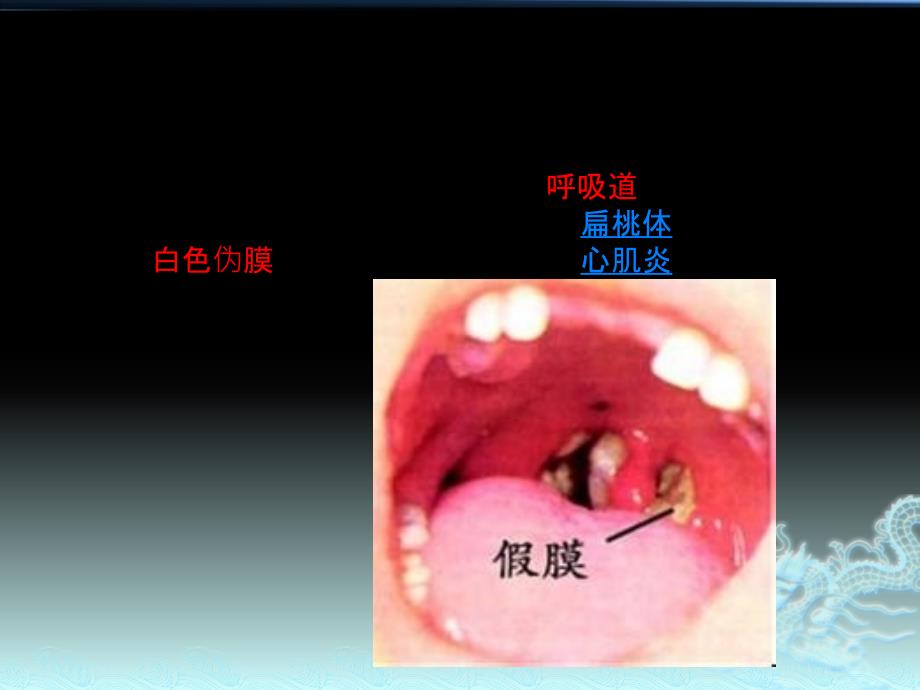 流行疾病的预防与处置 ppt课件_第4页