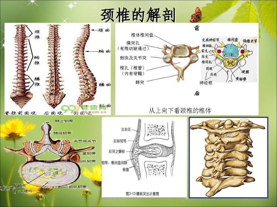 颈椎病护理(实习生讲座)_第4页