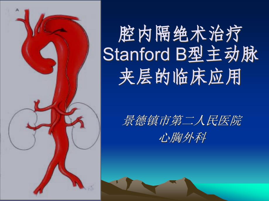 腔内隔绝术治疗Stanford_第1页