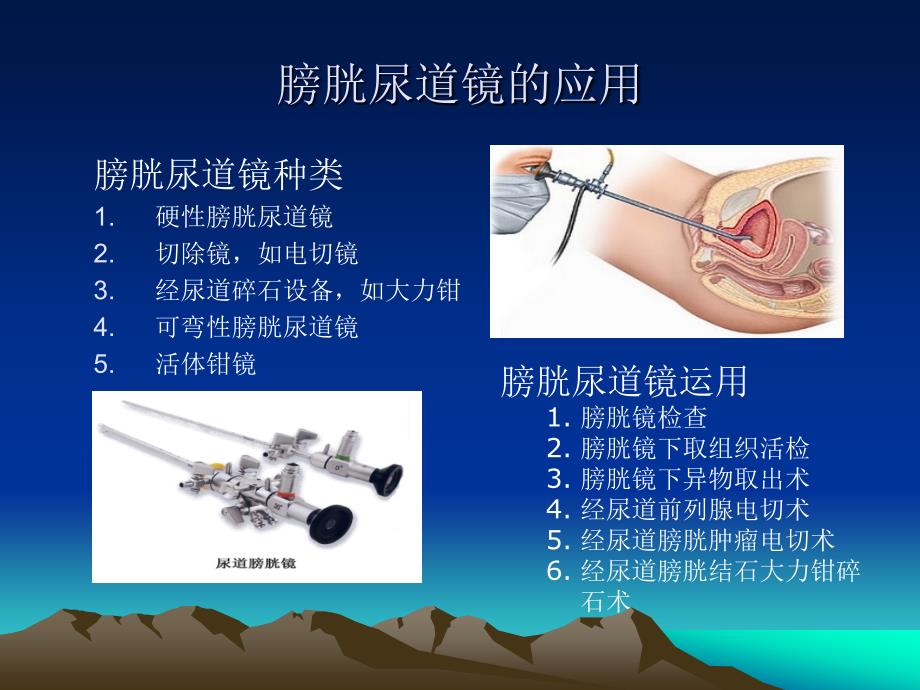 内镜在泌尿外科应用_第4页