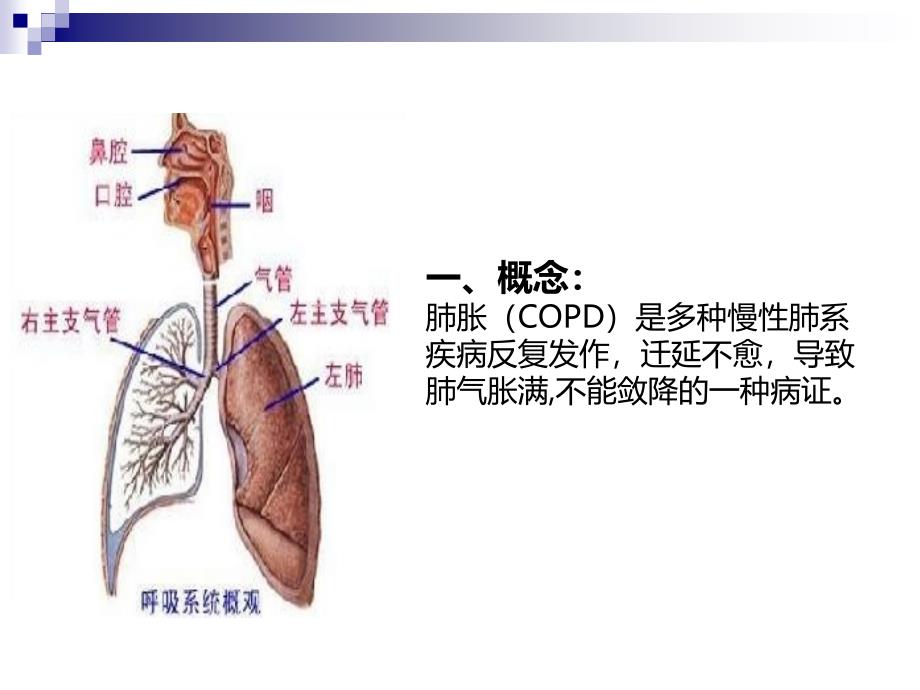 肺胀中医护理查房(2学时)课件_第2页