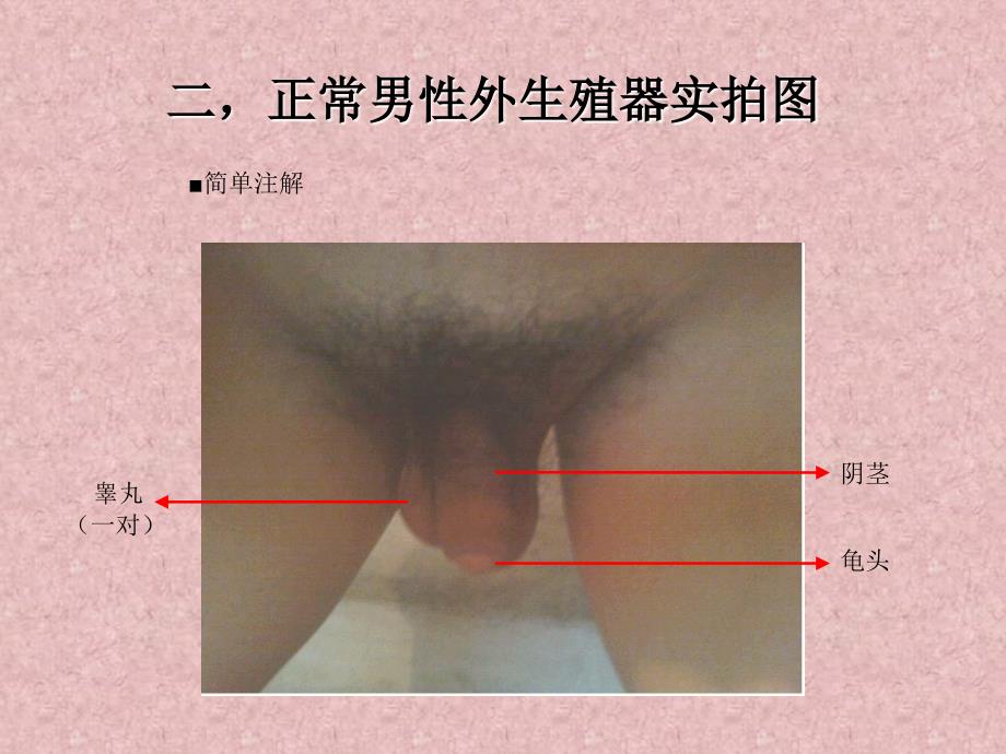 男性生殖器-图解普及版-张蓉等编_第4页