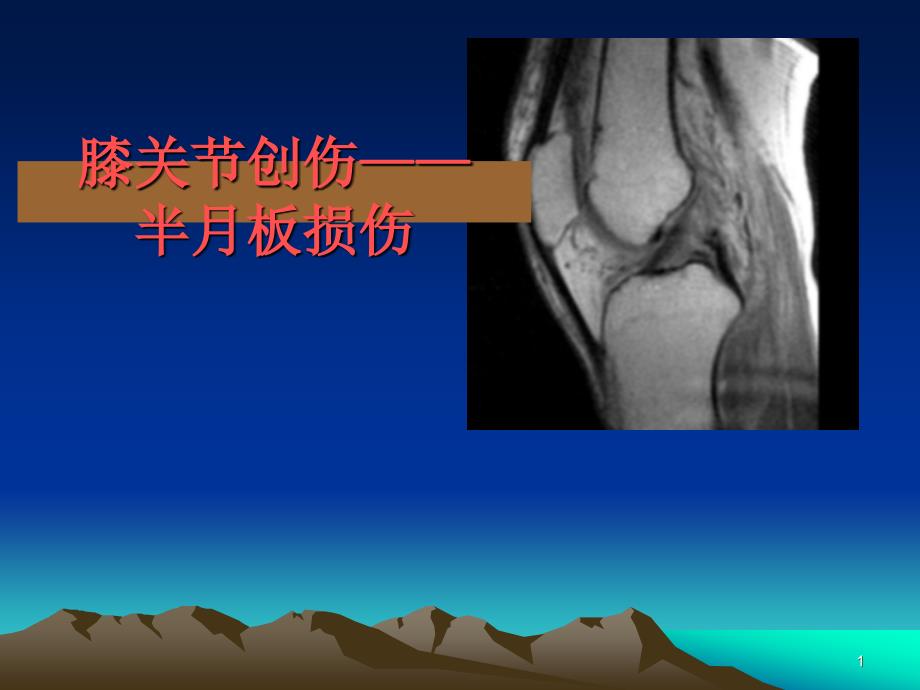 膝关节 损伤MR影像表现_第1页